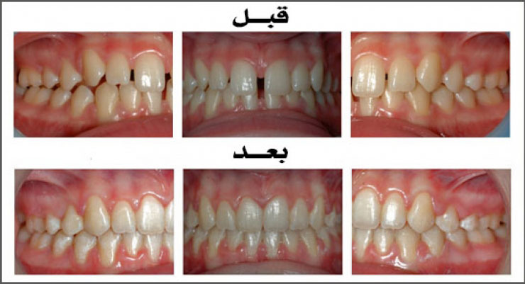 الحالة (4)