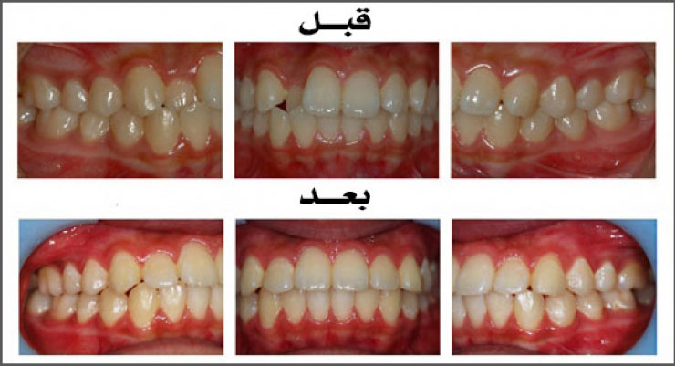 الحالة (5)