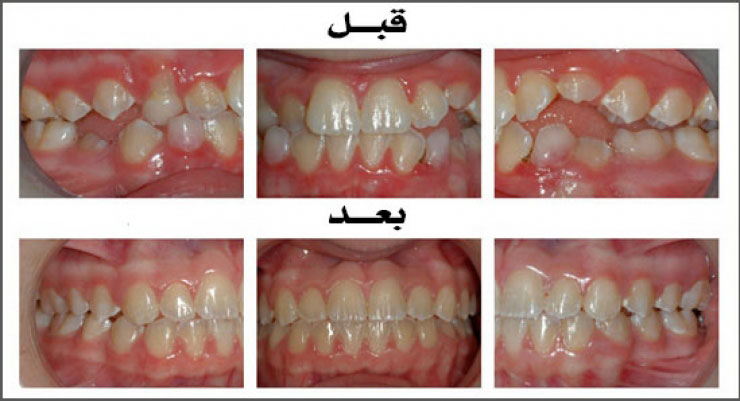 الحالة (6)