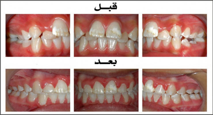 الحالة (7)