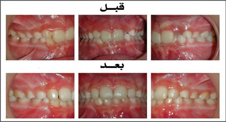 الحالة (9)