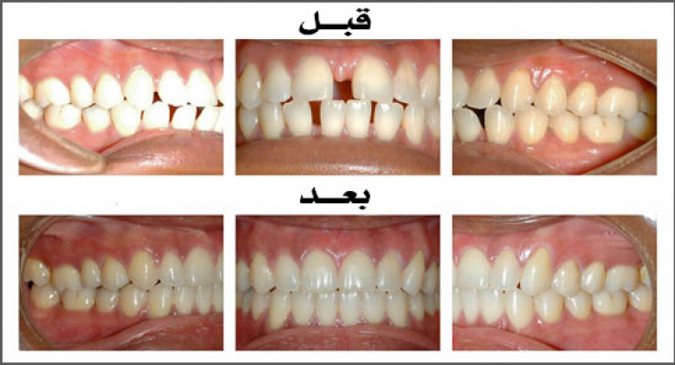 الحالة (1)