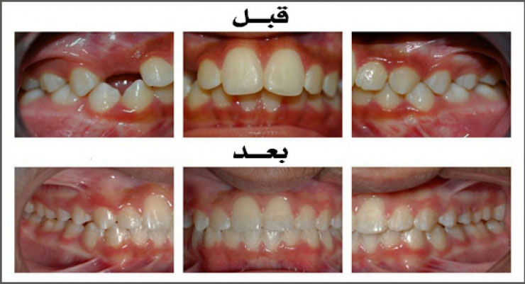 الحالة (2)