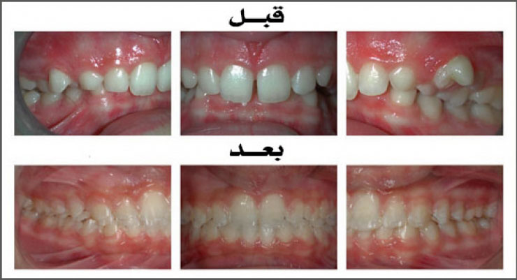 الحالة (3)